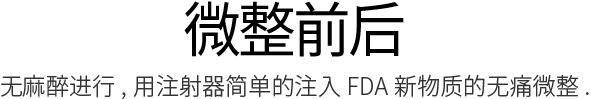 女性私密整形, 阴道整形 , 小阴唇整形 ,韩国女性整形, 韩国私密整形, 韩国江南妇产科